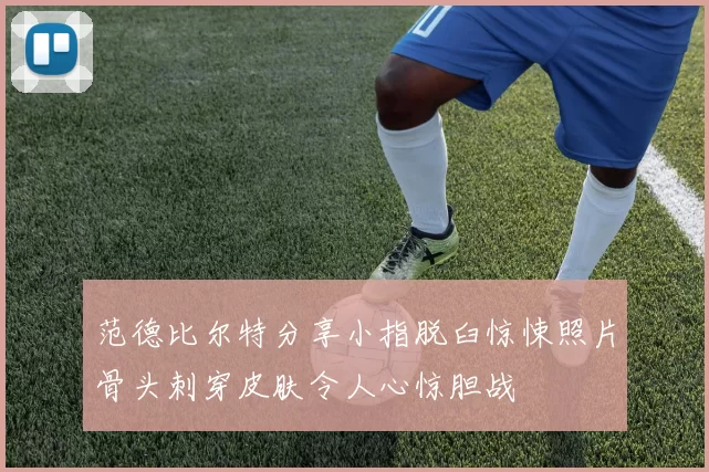 范德比尔特分享小指脱臼惊悚照片骨头刺穿皮肤令人心惊胆战